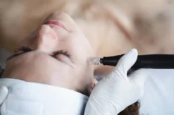 Microneedling Düsseldorf (60 Min.)