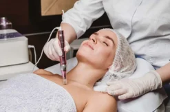 Microneedling Kochel am See